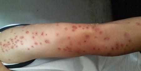 臭蟲在水里泡多久才會(huì)死，家里有臭蟲，怎么樣才能快速除掉呢？圖4