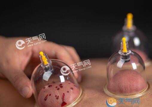 拔罐24小時(shí)不能洗澡嗎