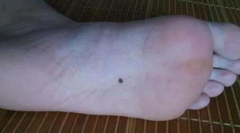 三處有痣菩薩轉(zhuǎn)世