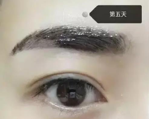紋眉幾天可以恢復(fù)自然 紋眉幾天可以恢復(fù)自然