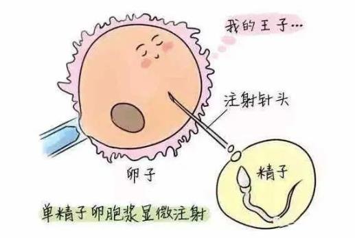 試管嬰兒怎么做的全過程 試管嬰兒怎么做的全過程