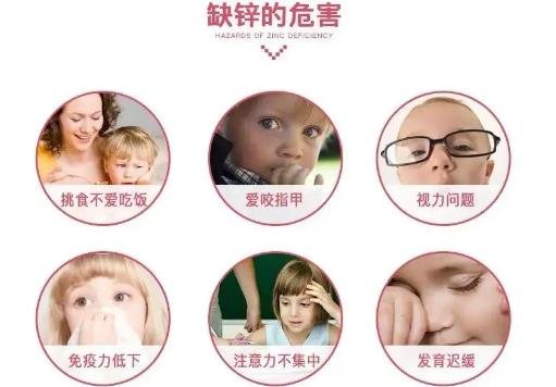 兒童缺鋅的10個表現(xiàn) 兒童缺鋅的10個表現(xiàn)