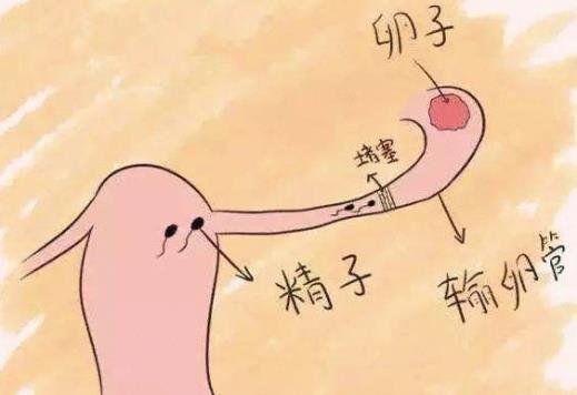 輸卵管堵塞的10個(gè)征兆 輸卵管堵塞的10個(gè)征兆