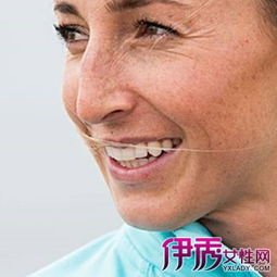 最有效最安全治療老斑的方法有哪些