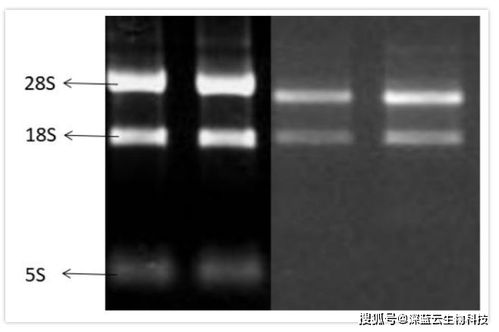 電泳檢測(cè)rna的方法有哪些