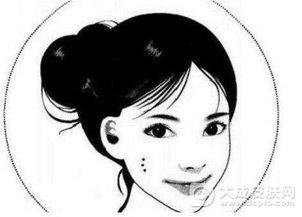 青島點痣方法有哪些