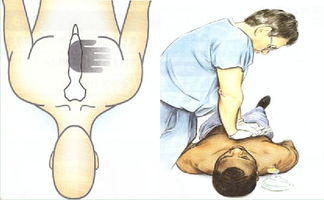 胸外心臟按壓的正確方法包括哪些