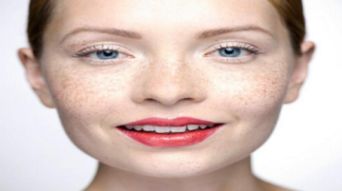 雀斑祛斑方法有哪些呢
