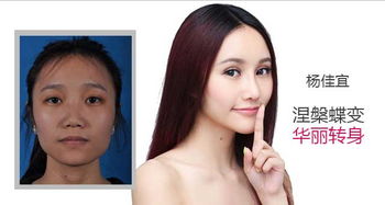 讓內(nèi)雙變外雙眼皮的方法有哪些