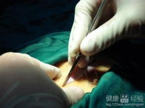 有哪些方法可以確定是癌