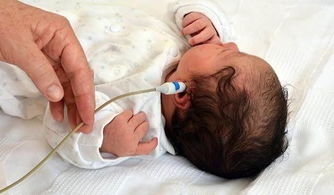 檢查甲狀腺的方法有哪些方法