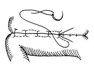 動物腸管縫合的方法有哪些