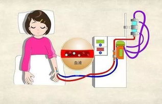 肌酐高的中醫(yī)治療方法有哪些