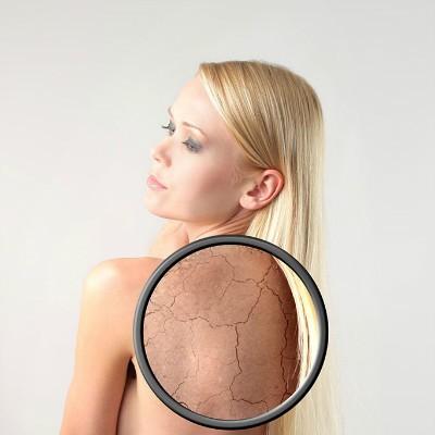 皮膚病,注意事項(xiàng),檢查