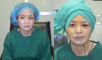 斜視手術(shù)前注意事項(xiàng)眼藥水,斜視手術(shù)后注意事項(xiàng),斜視手術(shù)恢復(fù)期注意事項(xiàng)