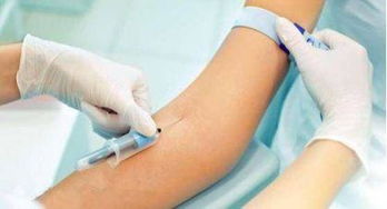 測血糖血脂之前注意事項,測血脂的注意事項,查血脂前注意事項