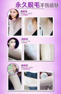 脫毛,迪斯,注意事項