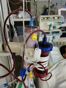 注意事項(xiàng),血液,濾過(guò)