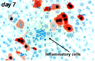 慢病毒轉(zhuǎn)染注意事項,lipo3000轉(zhuǎn)染質(zhì)粒注意事項,脂質(zhì)體轉(zhuǎn)染注意事項