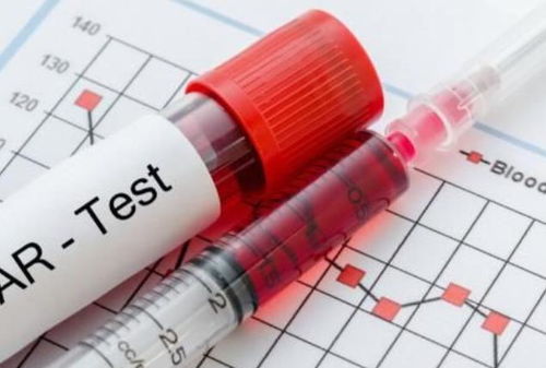 血糖,注意事項,檢測,快速