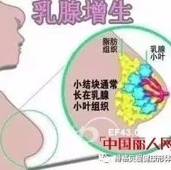 小葉增生的注意事項(xiàng),雙乳小葉增生怎么辦,要注意些什么,小葉增生術(shù)后注意事項(xiàng)