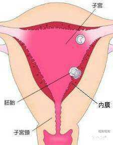 試管宮腔鏡手術(shù)后注意事項(xiàng),宮腔鏡后注意事項(xiàng)和飲食注意,宮腔鏡手術(shù)后注意事項(xiàng)