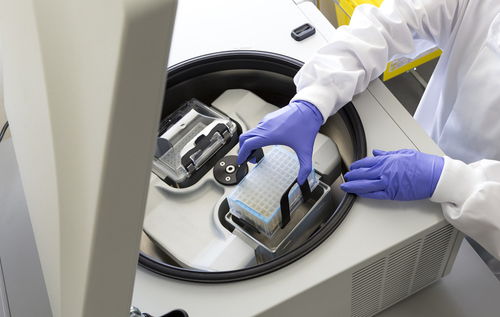 宮頸tct和hpv檢查注意事項,女性宮頸檢查hpv注意事項,宮頸檢查后注意事項