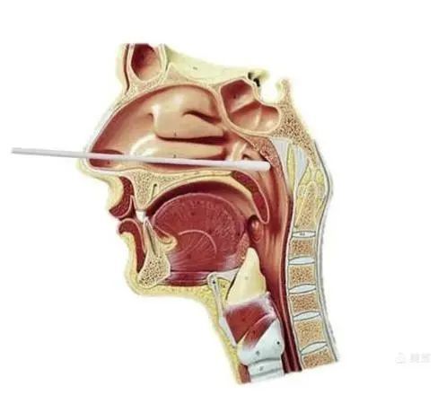 咽拭子采集注意事項,新型冠狀病毒口咽拭子采集注意事項,核酸咽拭子采集注意事項