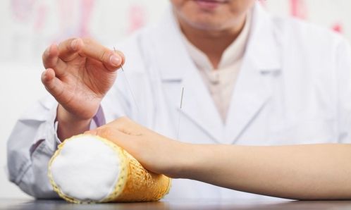 針刺翳風注意事項,針灸風府注意事項,針灸風池風府注意事項