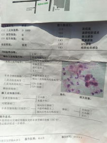 tct檢查前注意事項,hpvtct檢查前注意事項,婦科tct檢查前注意事項