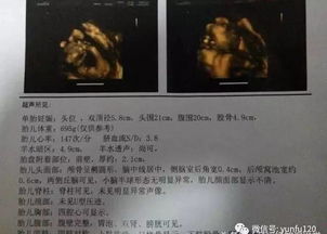 四維注意事項(xiàng)