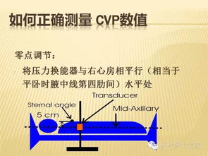 簡述測量cvp的注意事項(xiàng),測量CVP的注意事項(xiàng),CVP注意事項(xiàng)