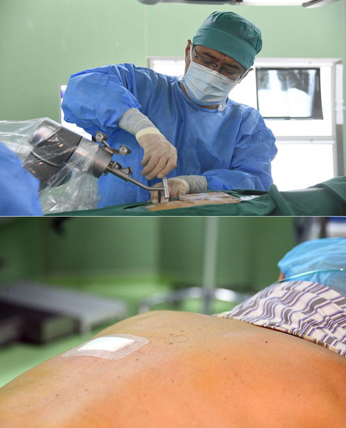 骨科手術(shù)鋪單的注意事項