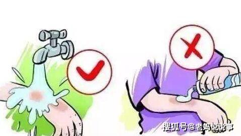 油燙傷后飲食注意事項,燙傷恢復期飲食注意事項,小孩燙傷飲食注意事項