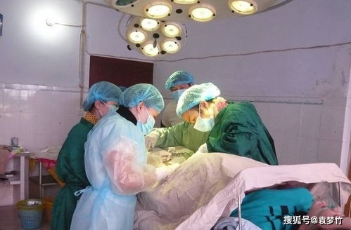 注意事項(xiàng),剖宮產(chǎn)