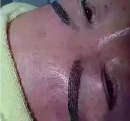 純植物紋眉注意事項(xiàng)