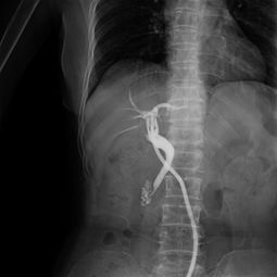 做輸卵管造影前后注意事項(xiàng),做心臟造影前后注意事項(xiàng),做造影后的注意事項(xiàng)