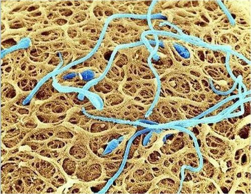 液化,注意事項(xiàng)