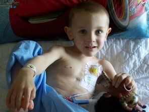 靜脈注射化療藥物的注意事項(xiàng)