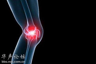 穿刺,關節(jié)炎,注意事項