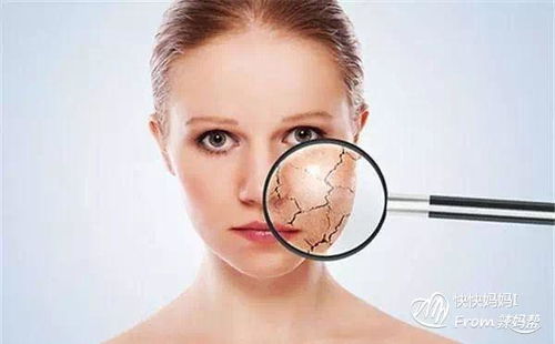 臉部手術(shù)后注意事項