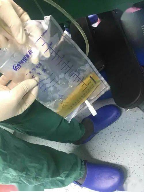 胸膜腔閉式引流的護理措施有什么,胸膜腔閉式引流的護理要點,關(guān)于胸膜腔閉式引流的護理,錯誤的是()