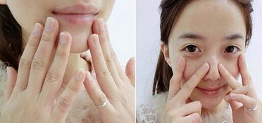 肉毒素打咬肌注意事項,打完瘦咬肌的注意事項,打完咬肌需要注意事項