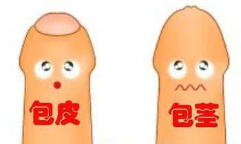 小孩包皮后注意事項