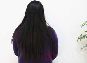 上海造影后注意事項(xiàng)