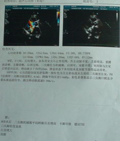 注意事項,機(jī)械