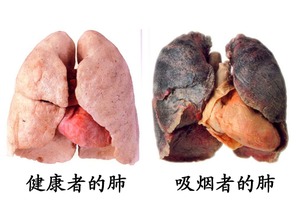 注意事項(xiàng)