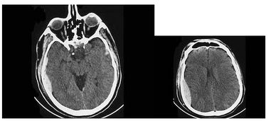 核磁管使用時(shí)的注意事項(xiàng)