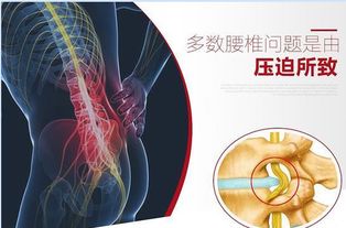 腰椎突出注意事項(xiàng)