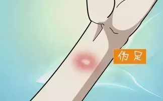 結(jié)合皮試注意事項